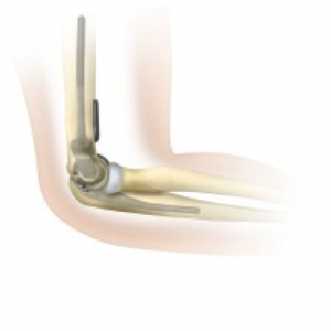 elbow2