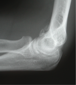 elbow4